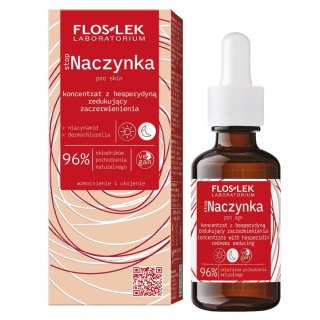 StopNaczynka koncentrat z hesperydyną redukujący zaczerwienienia 30ml Floslek