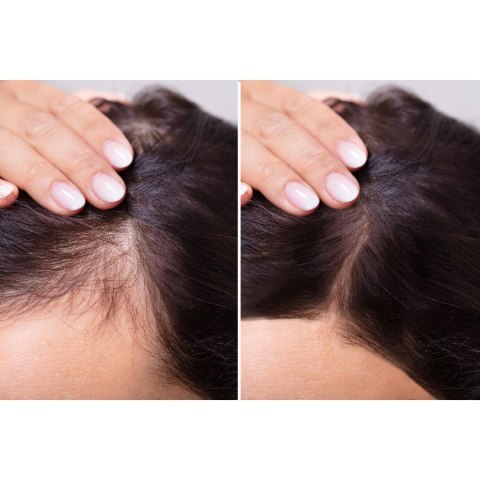 Carin Botea Tonic Shampoo 6.0 Szampon na Porost Włosów 250ml Carin Botea Tonic Shampoo 6.0 Szampon na Porost Włosów 250ml